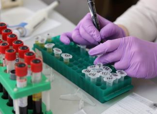 Ebola-geneesmiddel goedgekeurd als Coronabehandeling