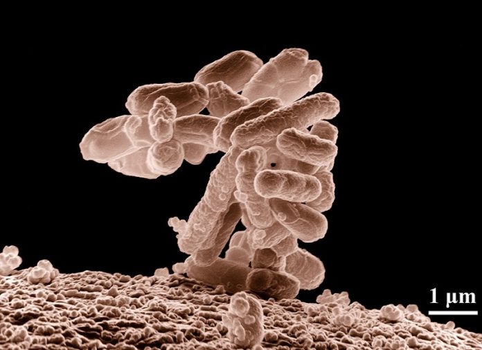 Bacteriën Ziekte Escherichia Coli Ziekteverwekkers Pixa