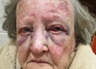 Zuid-Afrika: 80-jarige vrouw door zwarten op haar boerderij wreed aangevallen
