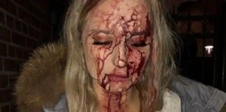 19-jarige Sophie stopte betaster – kreeg een vuistslag en een glazen fles verpletterd in haar gezicht