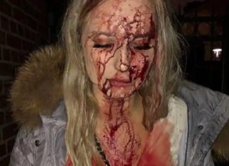19-jarige Sophie stopte betaster – kreeg een vuistslag en een glazen fles verpletterd in haar gezicht