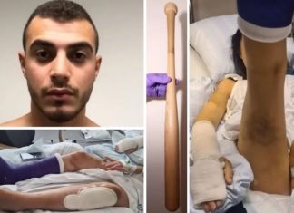Mohammad martelde zijn vriendin toen ze uit elkaar wilde gaan – verbrijzelde 11 botten met honkbalknuppel