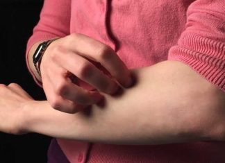 Studie toont aan dat huiduitslag een bijwerking is van het COVID-vaccin