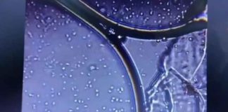 Horror: Pfizer vaccin ingezoomd met microscoop – levende organismen?
