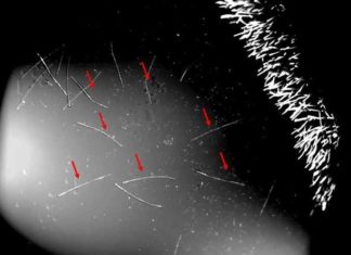 PCR-teststaafje deeltjes kunnen als asbest in het lichaam werken