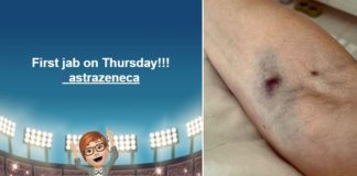 Brits model keek uit naar haar AstraZeneca-vaccin – sterft aan ‘zeer zeldzame’ bloedstolsel