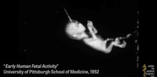 Kijk: Universiteit experimenteert met lichaamsdelen van geaborteerde baby’s