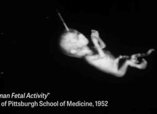Kijk: Universiteit experimenteert met lichaamsdelen van geaborteerde baby’s