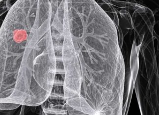 Vaccin VEROORZAAKT TURBOKANKER: T-cel-leukemie kan snel vorderen door mRNA-boosterprik