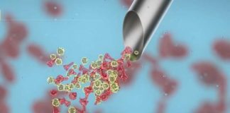 Voor altijd ziek: COVID-19 VACCINS veroorzaken ernstige ontstekingen, waardoor reeds op bestaande chronische gezondheidsklachten, ziekten, aandoeningen “gericht” wordt en verergeren