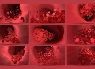 Nieuwe studie: bloedstolselrisico bij 18-39-jarigen door AstraZeneca twee keer zo hoog als overlijdensrisico door Covid