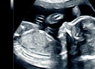 Mutant-baby’s na mRNA vaccinatie? Wetenschappelijk artikel onthult beangstigende vaccinatierisico’s