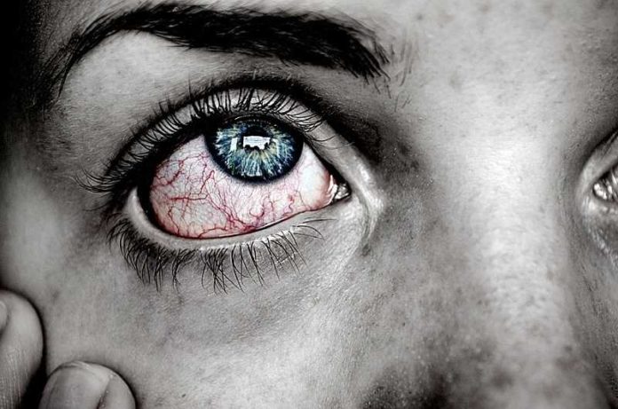 eye-743409_960_720 ziek vaccin pixa