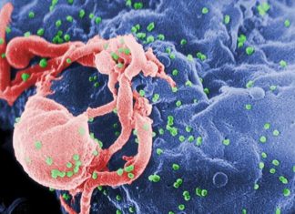 HIV bevestigd bij gevaccineerden!