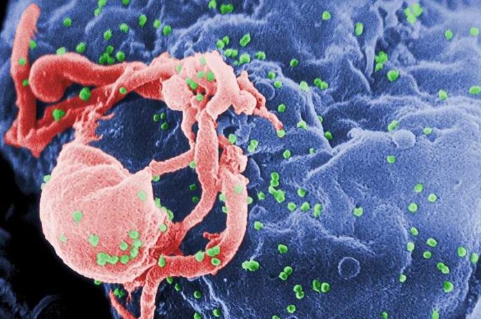 1280px-HIV-budding-Color