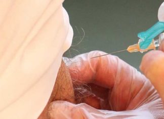 Wilde Covid vaccinpas – probeerde zich te laten inenten met nep-arm