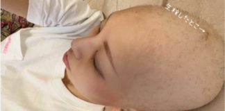 Wil je kaal worden? Neem een covid “vaccin!”