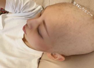 Wil je kaal worden? Neem een covid “vaccin!”