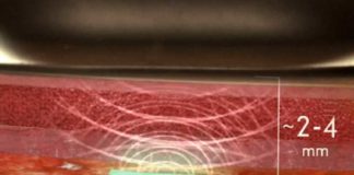Wie is ingeënt tegen corona en wie niet? Is geïnjecteerde hydrogel en grafeenooxide bedoeld om dit te controleren?