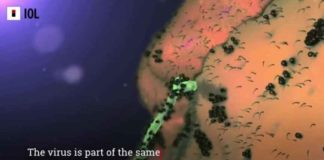 Een dringende videoboodschap aan de wereld: Crisis, Marburg virus ziekte – Oplossing, Ricine-rijk vaccin – Mogelijk resultaat, vaccin-geïnduceerde vergiftiging