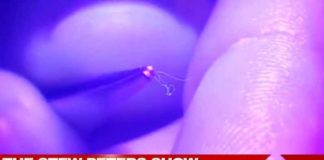 Video beweert metalen ‘draad’ te zien wiebelen na verwijdering uit het lichaam van gevaccineerde persoon