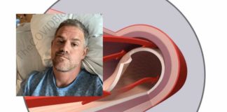 Eric Turner: 41-jarige bodybuilder hoopt dat Ivermectine “idioten uitroeit,” lijdt aan kransslagader dissectie zes maanden na tweede mRNA-injectie