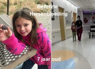 7-jarig meisje krijgt beroerte en hersenbloeding 7 dagen na Pfizer COVID-19 injectie