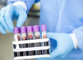 Gevaccineerd bloed – Het dilemma van COVID’s experimentele transfusies