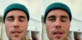 Justin Bieber annuleert hele wereldtournee voor 2023 wegens gezichtsverlamming na “vaccin”