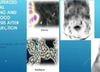 Computergestuurde thermografische beeldvorming en analyse van levend bloed na COVID-19 injectie