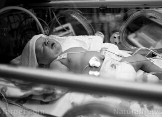 Arm van pasgeboren baby GEAMPUTEERD nadat moeder COVID-19 vaccins nam en baby bloedstolsels kreeg in de baarmoeder