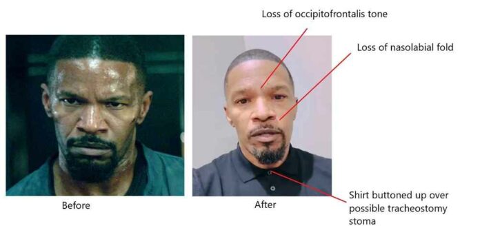 Jamie Foxx