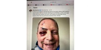 Gekneusde en bebloede volledig gevaccineerde dokter, met een nekbreuk, zegt grijnzend tegen de rest van ons dat we ons moeten blijven “vaccineren” …
