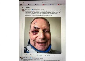 Gekneusde en bebloede volledig gevaccineerde dokter, met een nekbreuk, zegt grijnzend tegen de rest van ons dat we ons moeten blijven “vaccineren” …