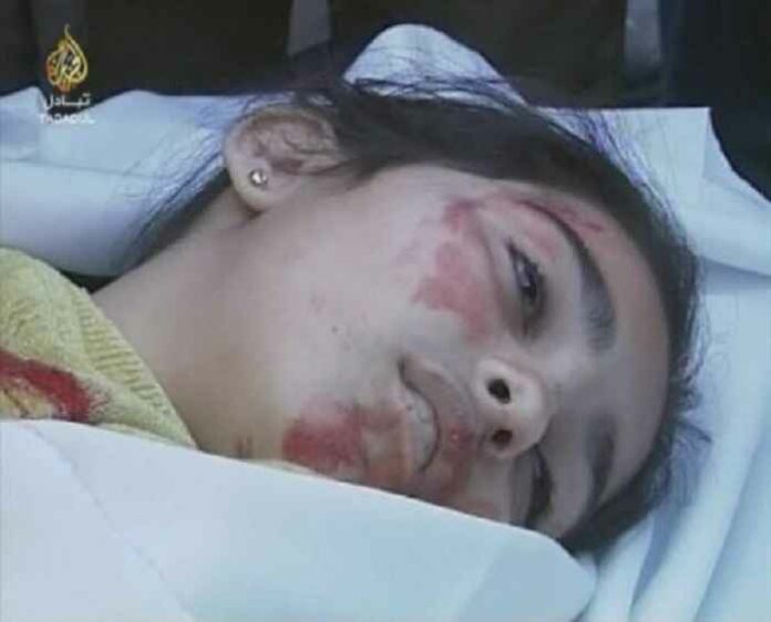 Close_view._Dead_Gaza_girl
