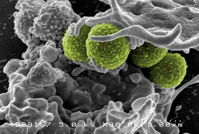 MRSA-Bacterie