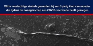 Witte vezelachtige stolsels gevonden bij een 3-jarig kind van een moeder die tijdens de zwangerschap een COVID-vaccinatie heeft gekregen